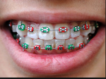 orthodontics