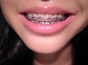 orthodontists